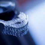 Invisalign w Lublinie